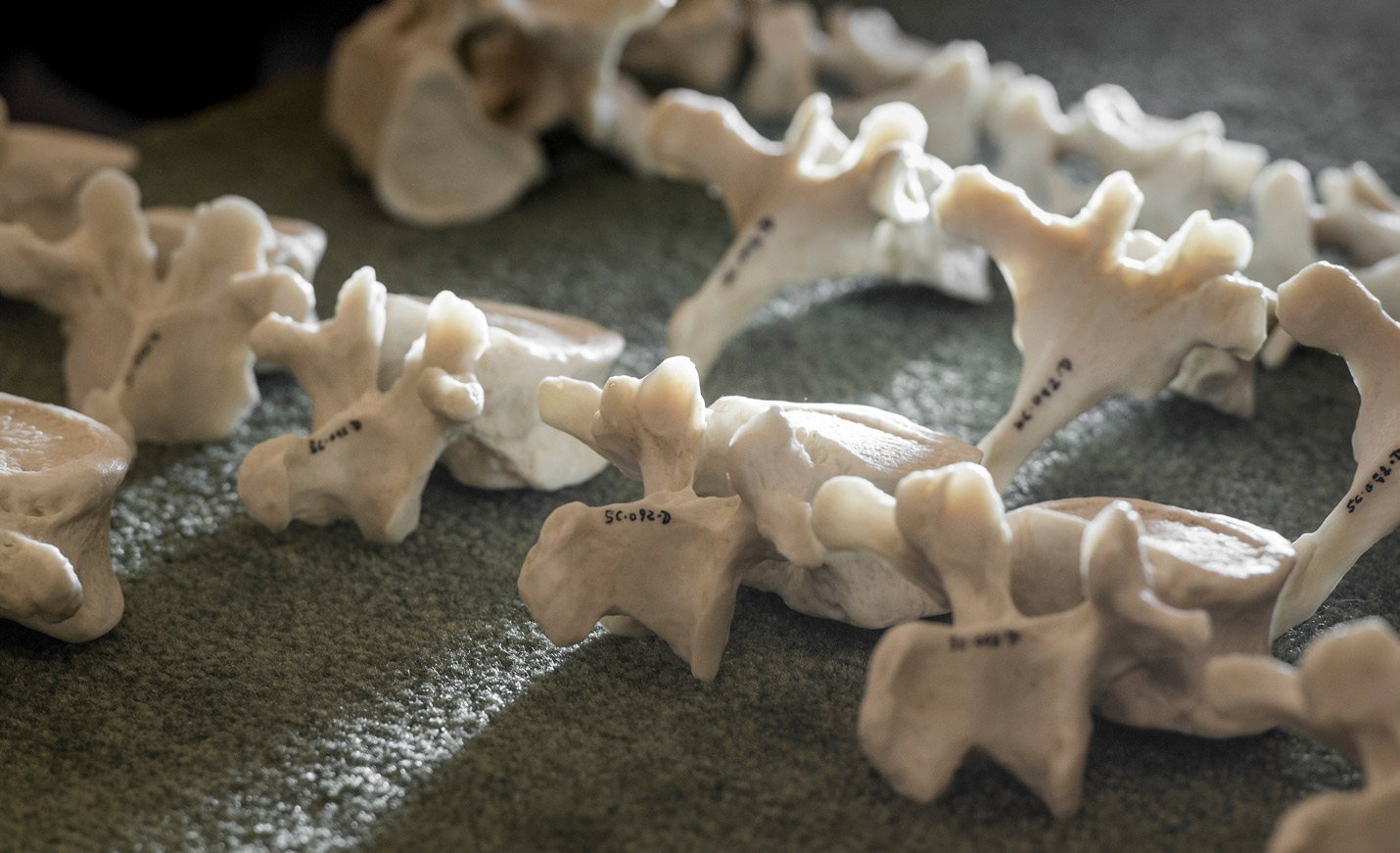 vertebrae